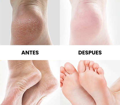 Crema para pies 180G